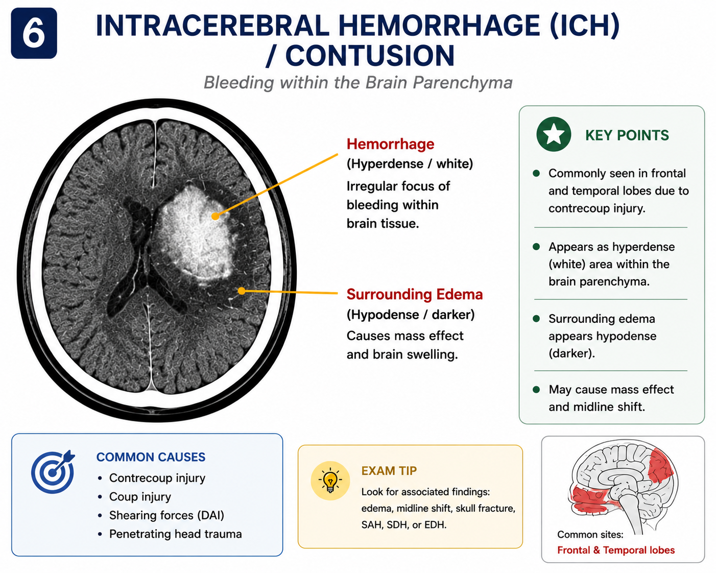 Intracerebral haemorrhage and cerebral contusion on CT